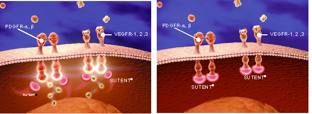 Sutent
